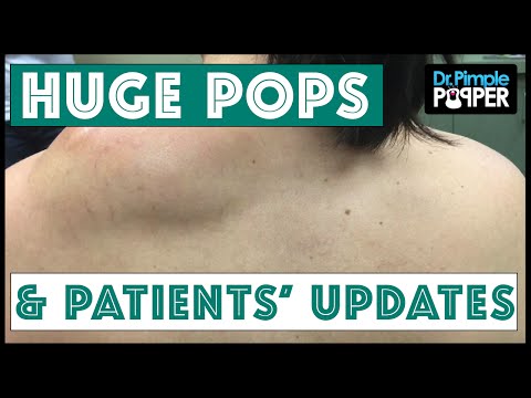 Some HUGE Past Pops and Updates!!