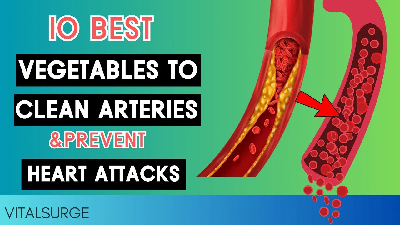 TOP 10 Best Vegetables To Clean Arteries and Prevent Heart Attacks & Stroke YouTube