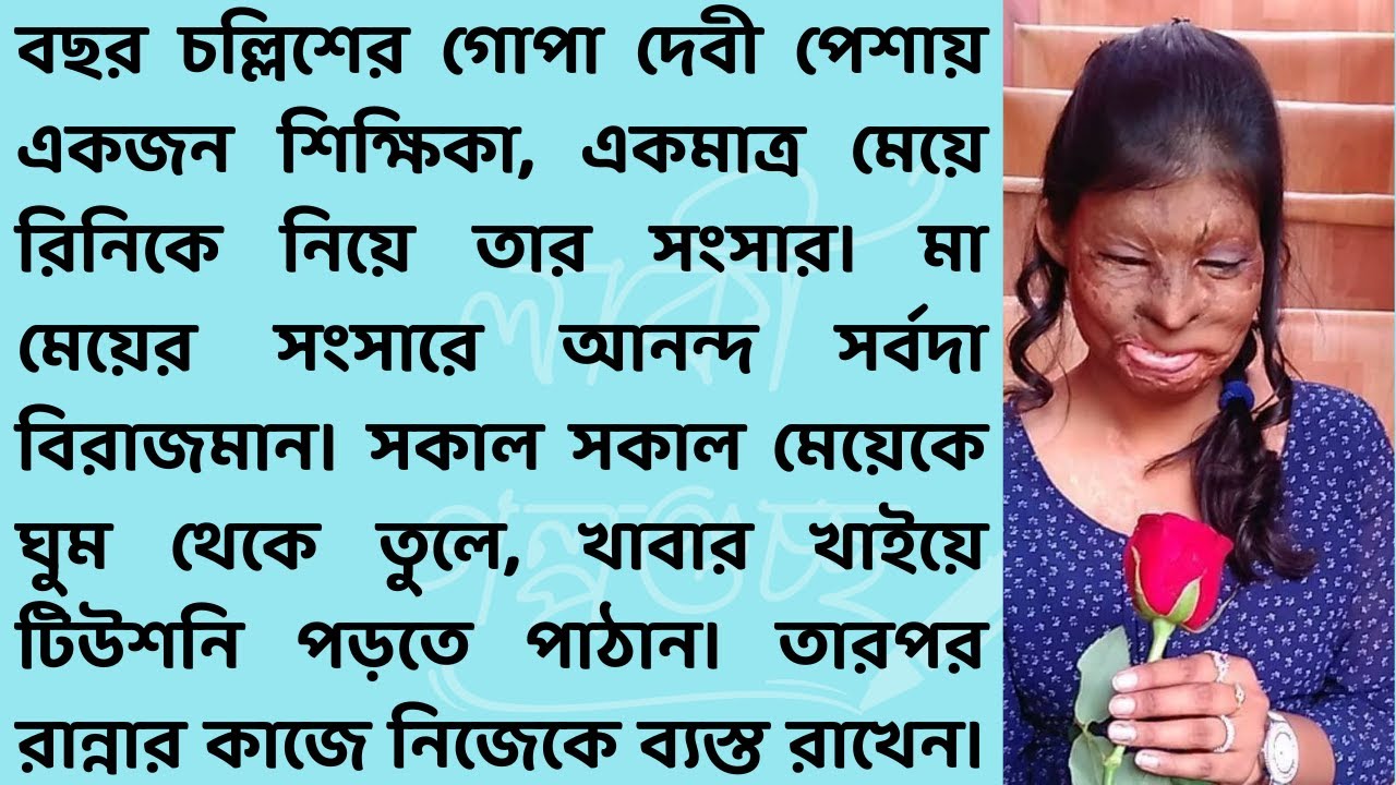 অ্যাসিড আক্রান্তের মা /Bangla new story //Bangla short story/ Bangla