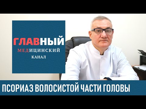 Псориаз волосистой части головы: симптомы, лечение и шампунь при псориазе головы