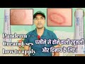 Panderm ++ Cream Uses, how to apply, Side-effects, Reviews details in hindi.