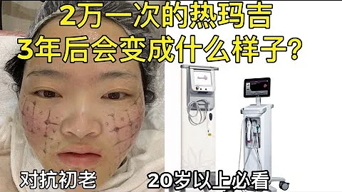 2万一次的热玛吉 电波拉皮，3年全记录分享！ - 天天要闻