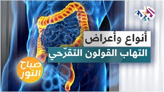 التهاب القولون التقرّحي .. الأنواع والأعراض والعلاجات