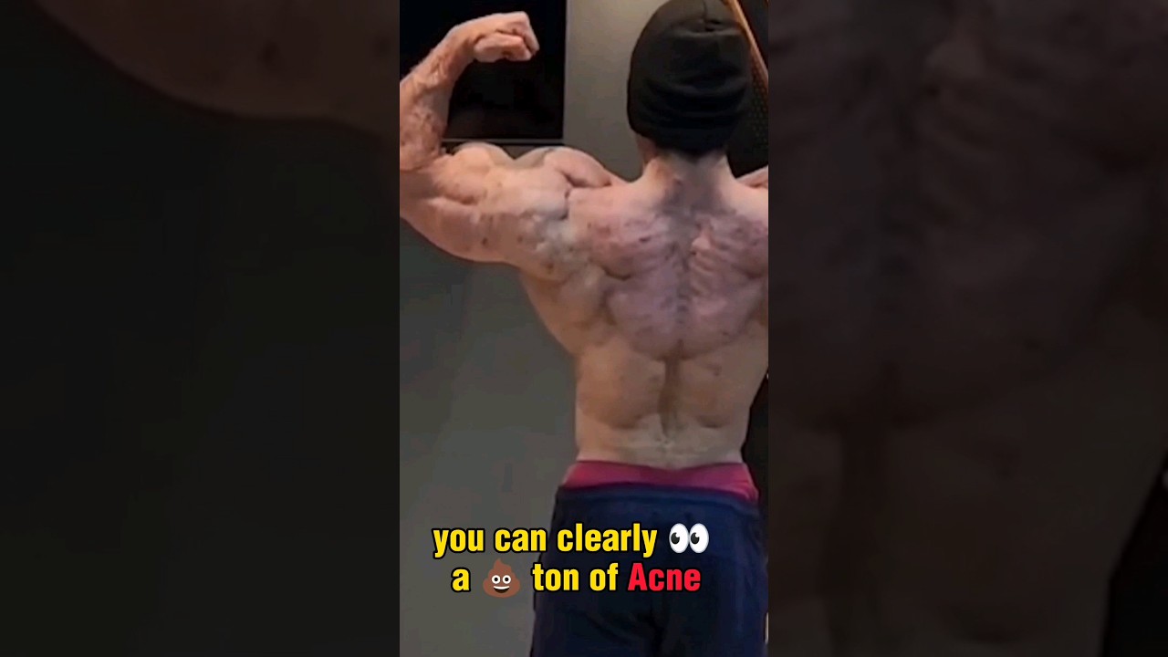 Steroids Ruined Him