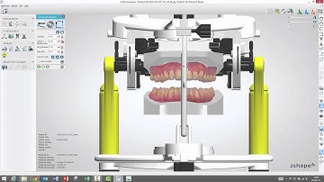 How to use the Virtual Articulator in Ortho Analyzer - powered by R+K CADCAM Berlin