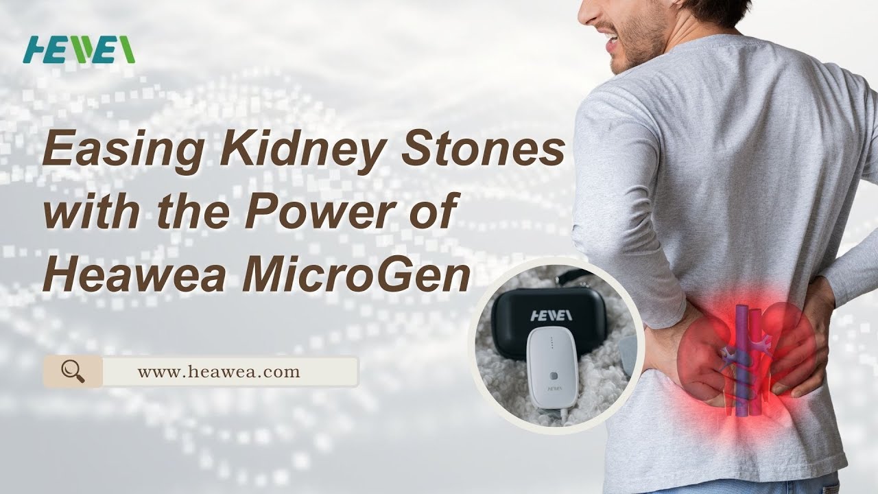 Easing Kidney Stones with the Power of Heawea MicroGen - YouTube
