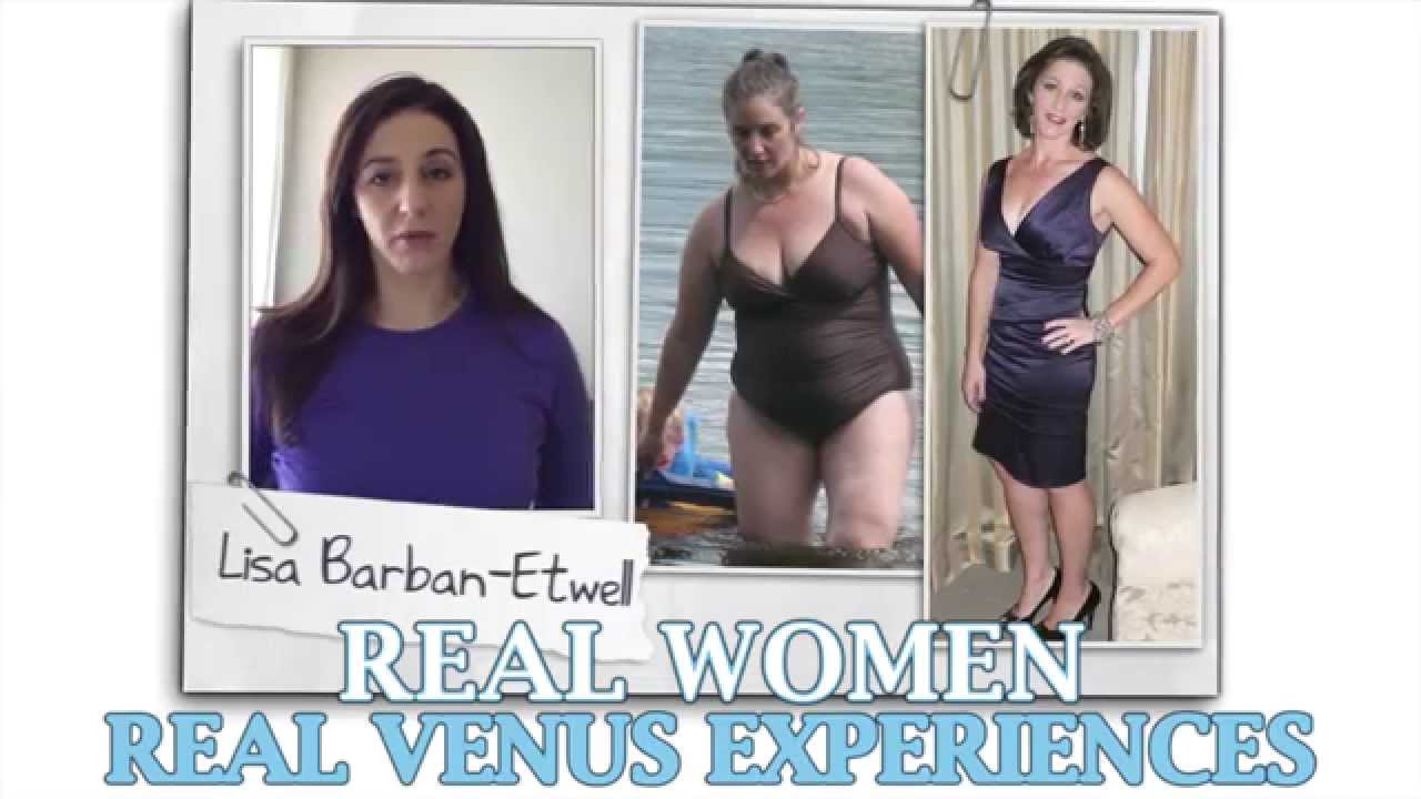 Venus Factor Real Review
