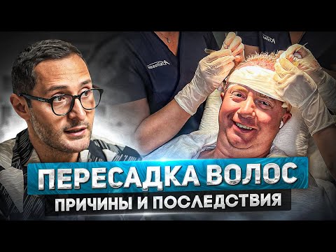 Все о пересадке волос у мужчин. Что делать, если появились залысины?