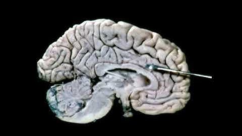 The Triune Brain (1984)