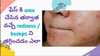 How to control redness/ bumps after face wax || Girls Planet Telugu