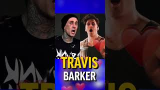 How Many Calories Do Drummers Burn In 1 Hour?