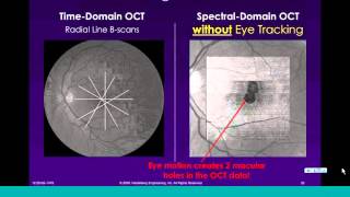 Spectral-Domain OCT – A Clinician’s View