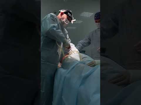Видео: Стенирането е хирургична процедура?