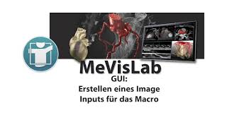 MeVisLab: Macro TumorSeg Image Input