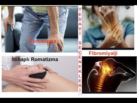 Romatizma, İltihaplı Romatizma, Fibromiyalji  Cesitleri ve Tedavisi