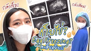 รีวิว การเก็บไข่? Egg freezing? คืออะไร เจ็บมั้ย? ละเอียดยิบ!! ll Bivoyage