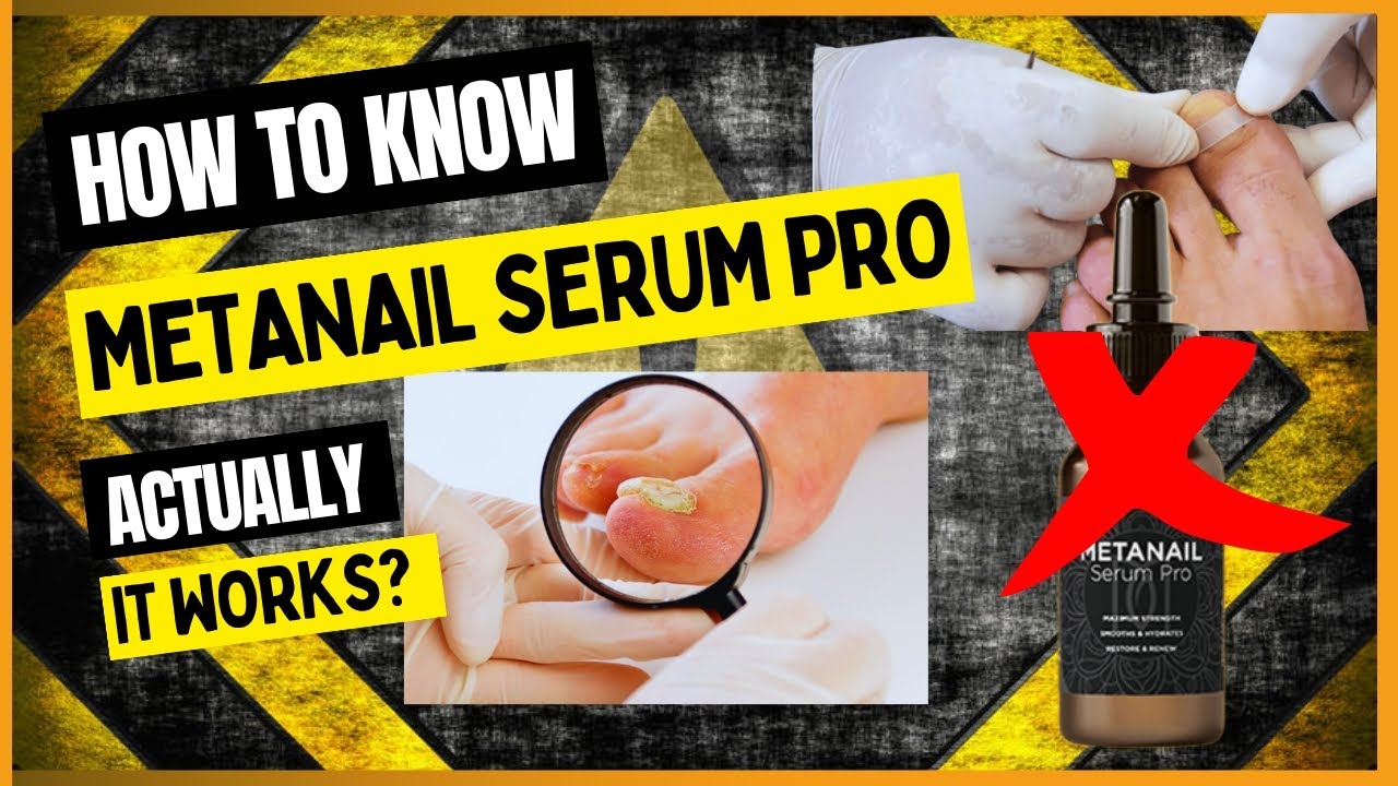 ⚠️Metanail Serum Pro⚠️ - 😡 Don't buy Metanail, Information you know about Metanail.❓