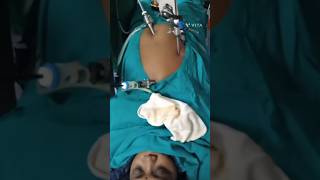 Laparoscopic Cholecystectomy Surgery 