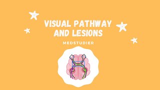 Visual Pathway and Lesions | MedStudier