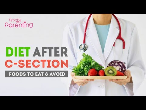 Video: Caesarean Section - What You Can Eat