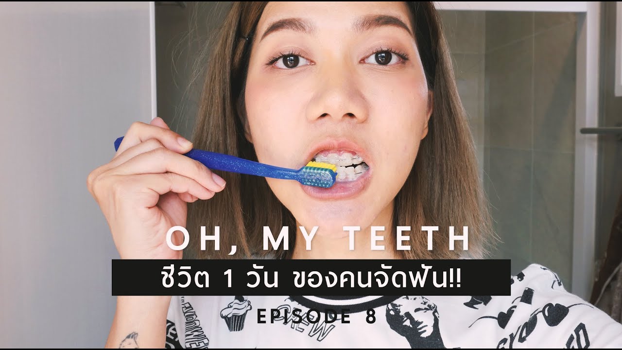 พามาดู 1 วันของมนุษย์จัดฟัน ใครอยากจัดฟันต้องดู ชีวิตเปลี่ยนไป 100%  . Ploy Sapphires | เนื้อหาทั้งหมดเกี่ยวกับอาหาร จัด ฟันที่แม่นยำที่สุด