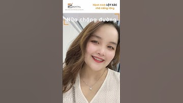 Hành trình LỘT XÁC nhờ niềng răng của Quế Linh