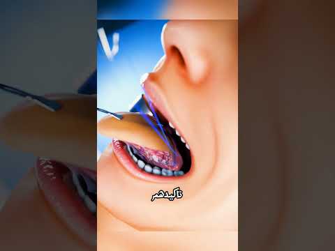 من ذراعها ص ن ع لها لسان فتكلمت مجدد ا