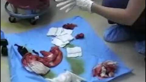 Counting Sponges in OR Video Lecture