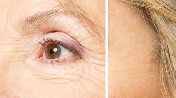 How to Remove Wrinkles in Photoshop