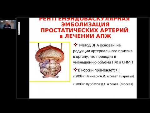 Современные возможности мужской ангиоандрологии. Бесплатный медицинский журнал "МедДон".