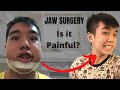 Jaw Surgery Transformation | SG