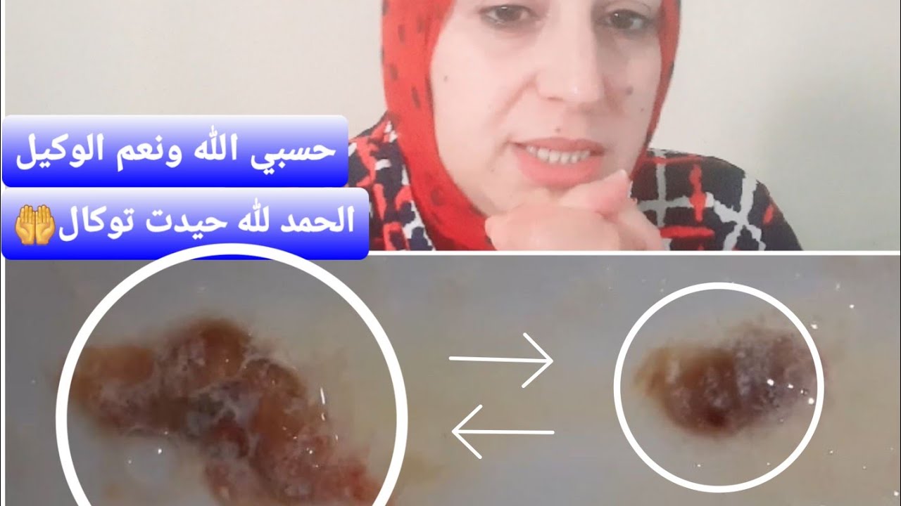 تجربتي مع التوكال.حسبي الله ونعم الوكيل