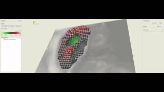 Locust tympanal membrane movement with 10 kHz sound.