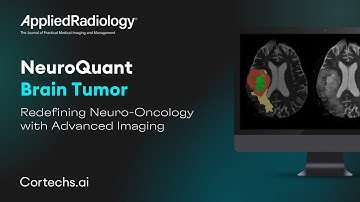 NeuroQuant Brain Tumor: Redefining Neuro-Oncology with Advanced Imaging