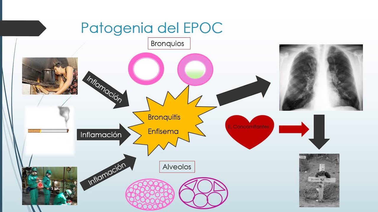 ordenar tapentadol en línea