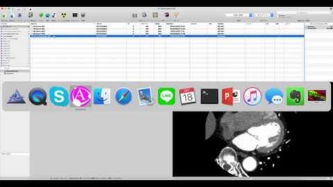 Basic 3D from OsiriX