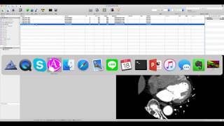 Famous Basic 3D from OsiriX Wealth