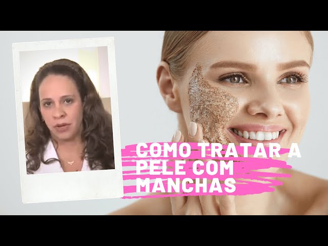 Como tratar uma pele com manchas   Dra.  Marcia Linhares