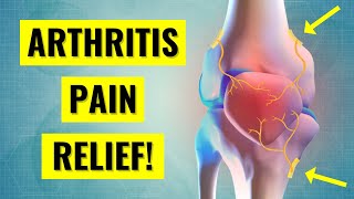 Genicular Nerve Block Treatment for Knee Arthritis Pain