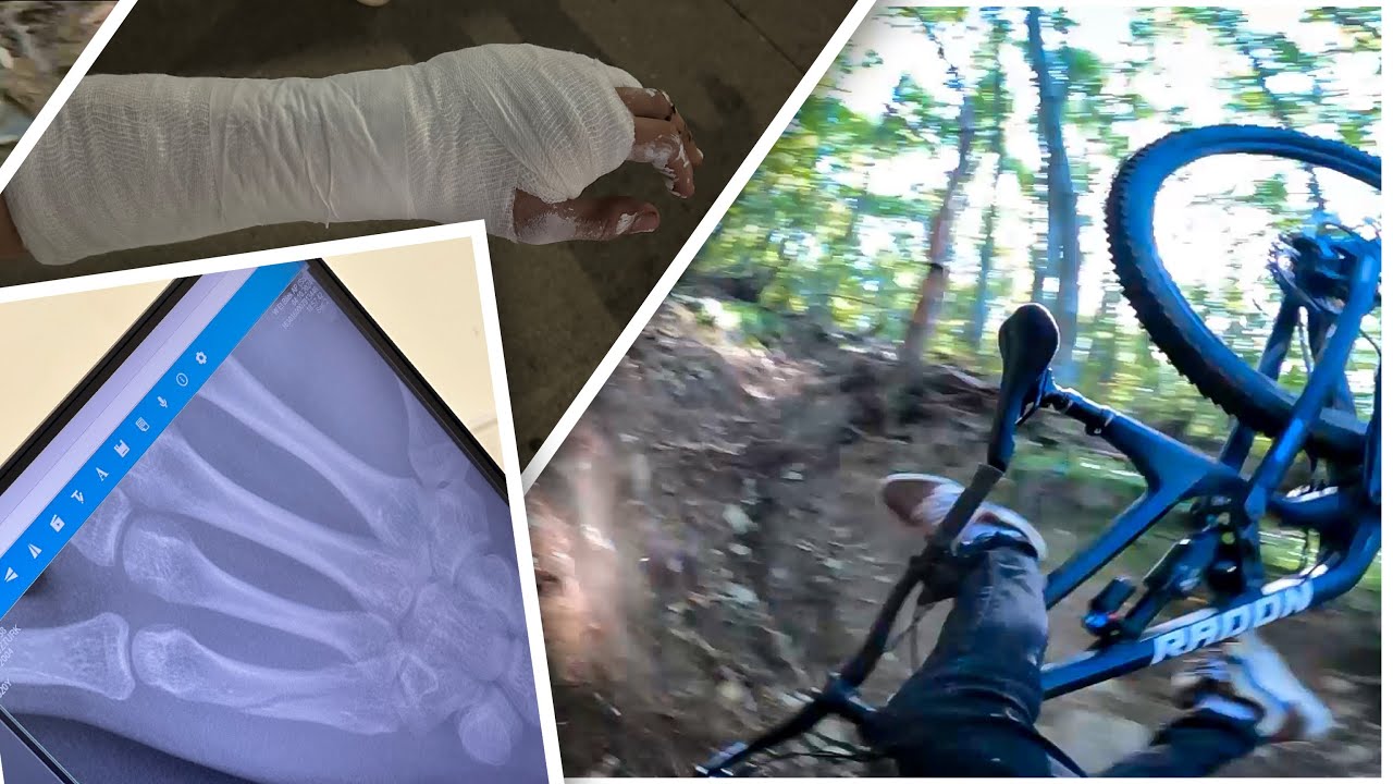 Uludağ Downhill - Eli KIRDIK !!!