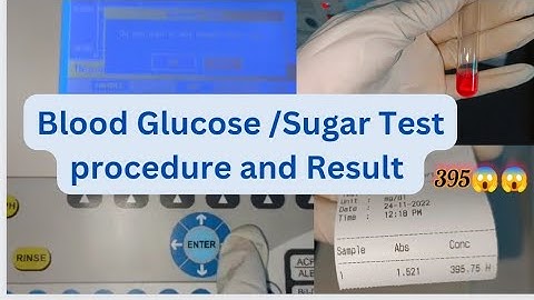 Blood sugar/Glucose Test procedure & Result in semiautomatic biochemistry analyser by GOD-POD Method
