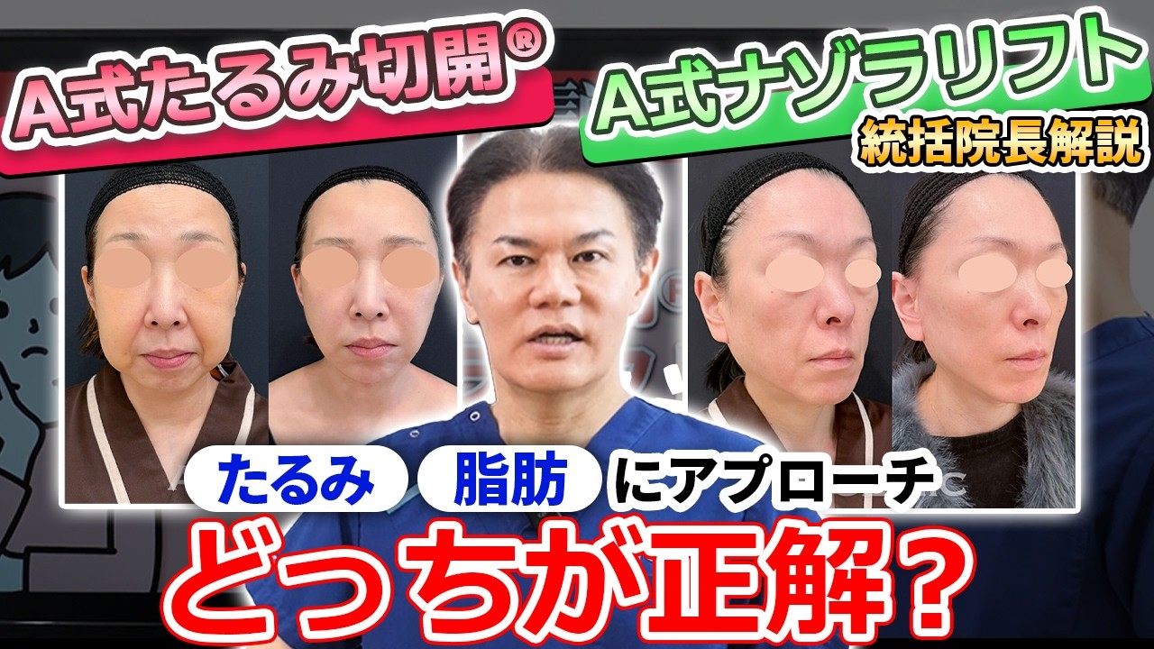 そのたるみ、安易に切らないで!A式たるみ切開®︎とA式ナゾラリフト、正しい適応を解説