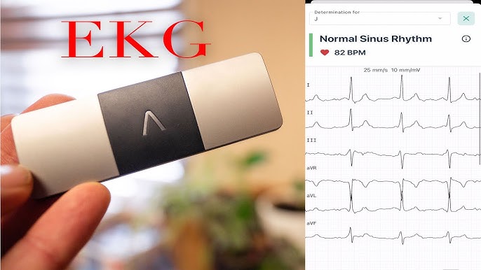 How to record an EKG with KardiaMobile 6L 