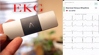 EKG at Home - KardiaMobile 6-Lead Personal EKG Monitor by JRESHOW 1,814 views 3 months ago 7 minutes, 12 seconds