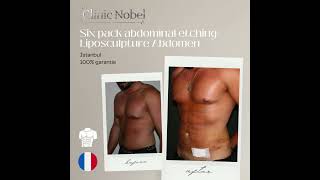 abdominal Etching six pack Net Worth