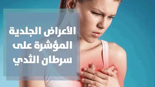 الأعراض الجلدية المؤشرة على سرطان الثدي والأمراض الجلدية المصاحبة للمصابات فيه