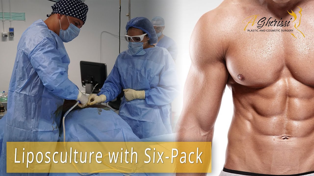 High Definition Liposculpture SixPack YouTube