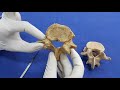 Lumbar vertebra..osteology