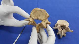 Lumbar Vertebra..osteology