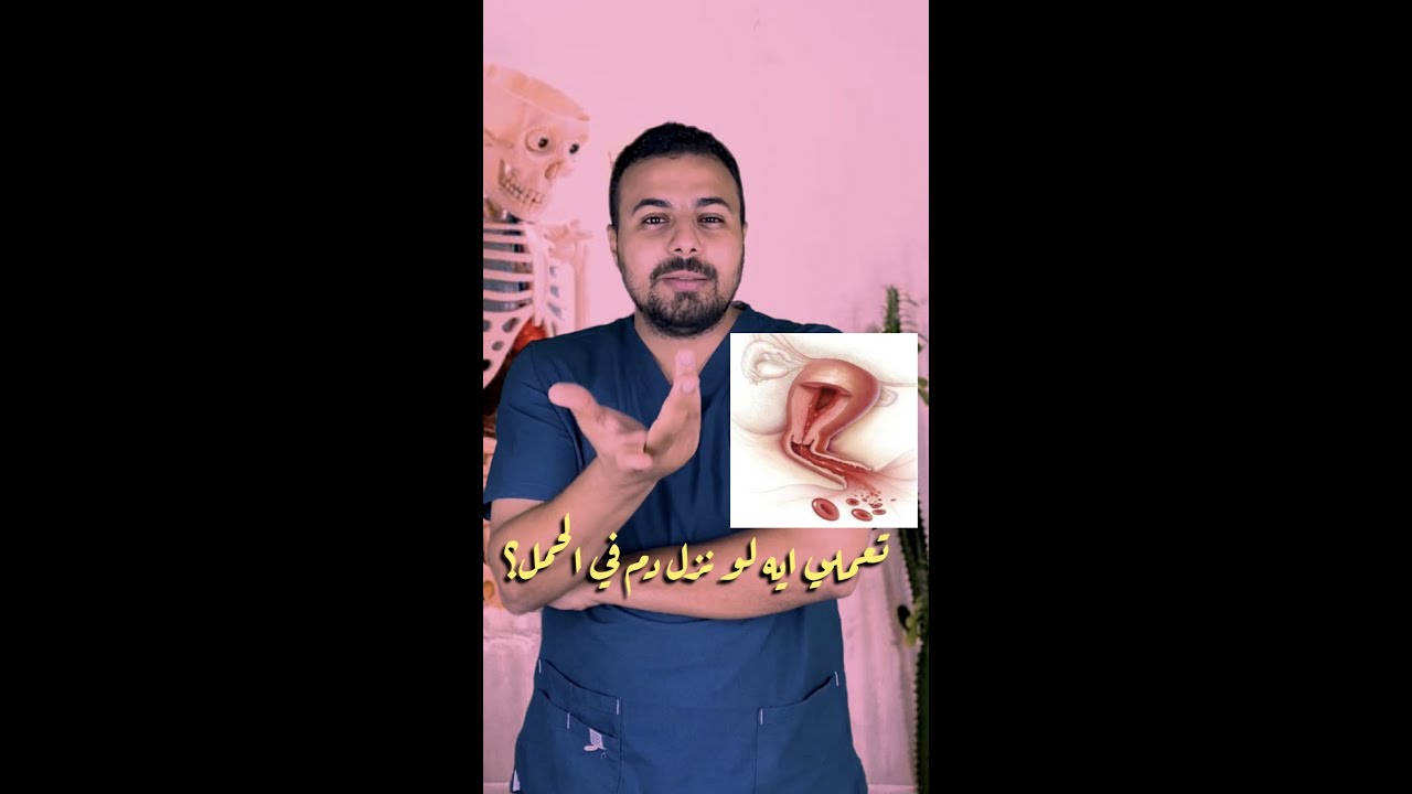 واجب نزيف الحمل